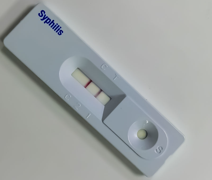 सिफिलिस एन्टिडिज द्रुत परीक्षण स्ट्रिप
